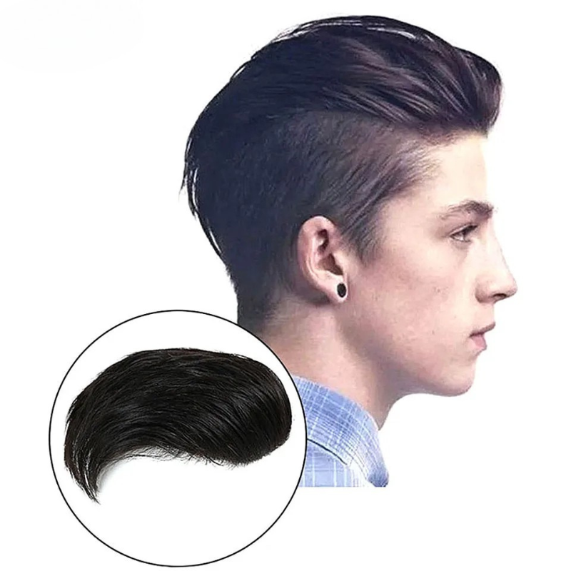 Wig x Hair Loss