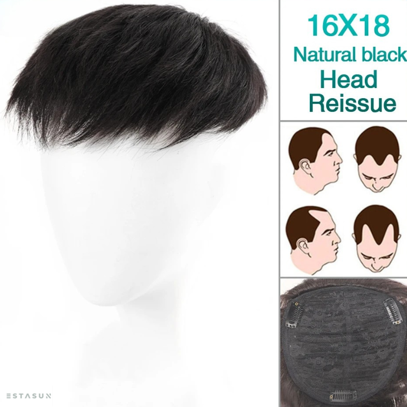 Wig x Hair Loss