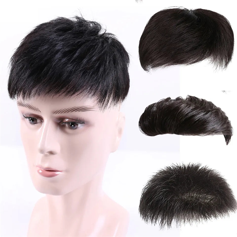 Wig x Hair Loss