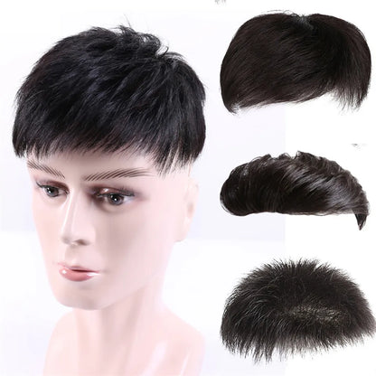 Wig x Hair Loss