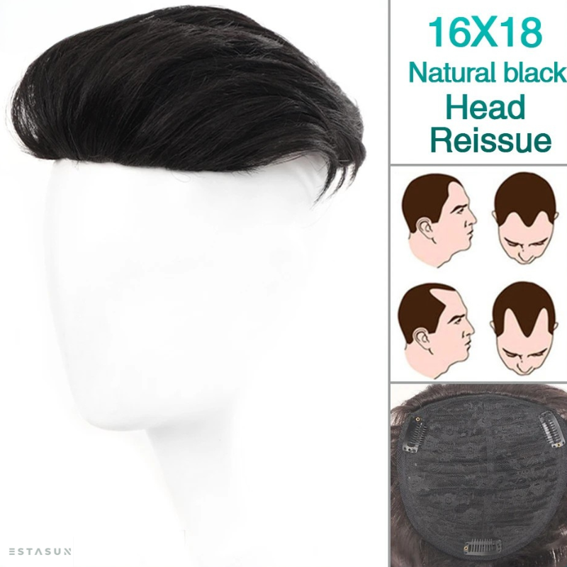 Wig x Hair Loss